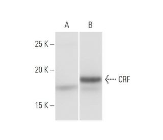 western blotting image from recommended CRF (2B11) monoclonal antibody replacement. Image 347546