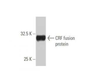 CRF Antibody (2B11) - Western Blotting - Image 348462Each CRISPR/Cas9 Knockout (KO) Plasmid product consists of a pool of 3 plasmids designed to ensure identification and cleavage of a specific gene for maximum knockout efficiency. Each plasmid encodes a unique 20 nt sequence derived from the GeCKO (v2) library.