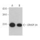 CRHSP-24 Antibody (D-6) - Western Blotting - Image 366790