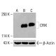 Anticuerpo CRIK (A-6): sc-398095. Análisis Western blot de la expresión de CRIK en lisados celulares completos de HCT-116 sin tratar (A) y tratados químicamente (B, C). β-Actina (C4): sc-47778 utilizado como control de carga. Reactivo de detección utilizado: m-IgG Fc BP-HRP: sc-525409. CRIK Antibody (A-6) - Western Blotting - Image 415370