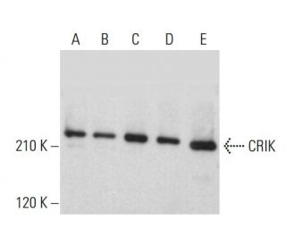 western blotting image from recommended CRIK (E-6) monoclonal antibody replacement. Image 382328