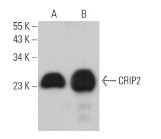 CRIP2 Antibody (G-12) - Western Blotting - Image 373500 