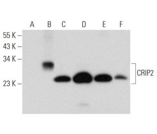 CRIP2 Antibody (H-10) - Western Blotting - Image 311979