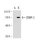 CRMP-2 Antibody (1B1) - Western Blotting - Image 38252