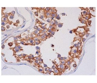 CRMP-2 Antibody (E-9) - Immunohistochemistry - Image 284729 