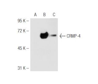 CRMP-4 Antibody (LL-5) - Western Blotting - Image 46937The Double Nickase Plasmid features a U6 promoter for sgRNA expression, a 20 nt targeting sequence, and a gRNA scaffold to guide Cas9n. It includes a CBh promoter for Cas9n (D10A) and puromycin resistance, GFP for transfection verification, and nuclear localization signals (NLS). The 2A peptide allows co-expression of Cas9n and Puro from a single promoter, enabling precise genome editing with reduced off-target effects.