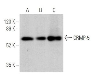 CRMP-5 Antibody (CR-1) - Western Blotting - Image 371130 