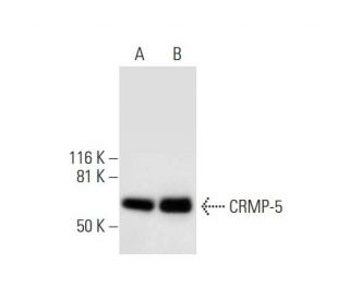 CRMP-5 Antibody (F-4) - Western Blotting - Image 294414 