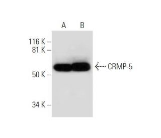 CRMP-5 Antibody (H-9) - Western Blotting - Image 294413 