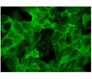 CROT Antibody (E-2) - Immunofluorescence - Image 298790 