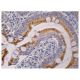 CROT Antibody (H-1) - Immunohistochemistry - Image 260803