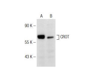 CROT Antibody (H-1) - Western Blotting - Image 146515 