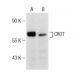 CROT Antibody (H-1) - Western Blotting - Image 146515 