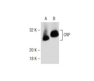 CRP Antibody (ML-12) - Western Blotting - Image 146326 