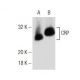 CRP Antibody (ML-12) - Western Blotting - Image 146326 