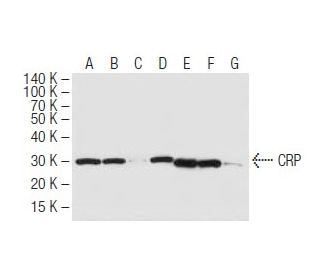 CRP Antibody (26D7) - Western Blotting - Image 62816