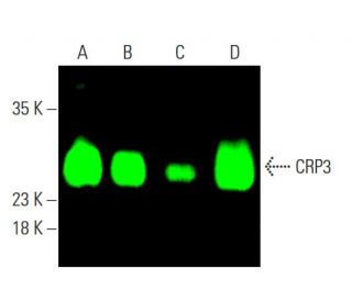 CRP3 Antibody (A-5) - Western Blotting - Image 385432Each CRISPR/Cas9 Knockout (KO) Plasmid product consists of a pool of 3 plasmids designed to ensure identification and cleavage of a specific gene for maximum knockout efficiency. Each plasmid encodes a unique 20 nt sequence derived from the GeCKO (v2) library.