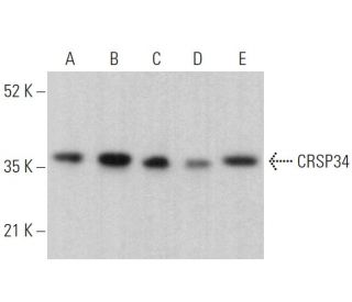CRSP34 Antibody (B-7) - Western Blotting - Image 379401 