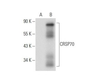 CRSP70 Antibody (E-11) - Western Blotting - Image 61873 