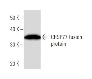 western blotting image from recommended CRSP77 (2215C3a) monoclonal antibody replacement. Image 16606