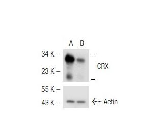 CRX shRNA Plasmid (h): sc-38649-SH. Western blot analysis of human CRX expression in CRX transfected (A) and CRX/CRX shRNA 