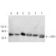 This polyclonal antibody has been discontinued. See our recommended <a href="cry1-antibody-h-12">CRY1 (H-12)</a> monoclonal antibody (sample data shown). western blotting image from recommended CRY1 (H-12) monoclonal antibody replacement. Image 358465