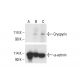 Cryopyrin/NALP3/NLRP3 Antibody (F-11) - Western Blotting - Image 412077 