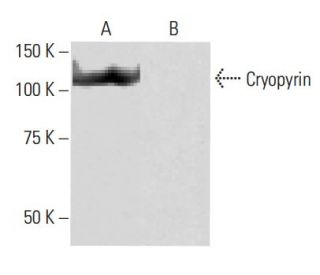 western blotting image from recommended Cryopyrin/NALP3/NLRP3 (6F12) monoclonal antibody replacement. Image 64900