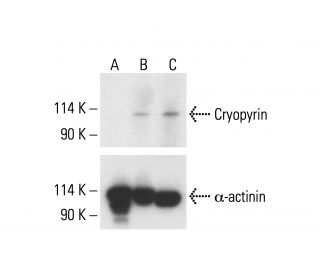 Cryopyrin/NALP3/NLRP3 Antibody (F-11) - Western Blotting - Image 412077SAM Transcription Activation: SAM system utilizing dCas9-VP64, MS2-P65-HSF1, and sgRNA for precise gene transcription activation.