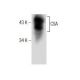 CSA Antibody (D-2) - Western Blotting - Image 164541 