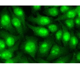 CSB抗体(D-7) | SCBT - Santa Cruz Biotechnology