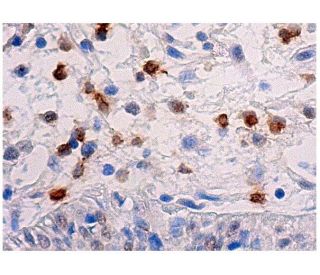 csb-antibody-d-7-