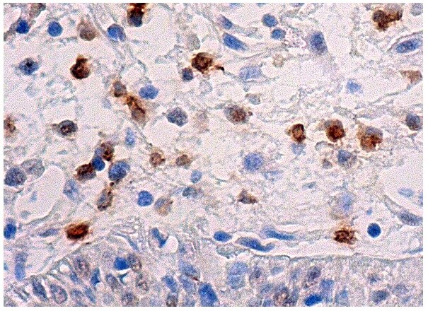 CSB Antibody (D-7) | SCBT - Santa Cruz Biotechnology