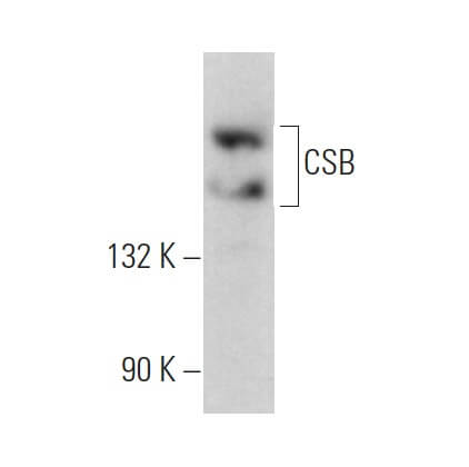 CSB Antibody (D-7) | SCBT - Santa Cruz Biotechnology