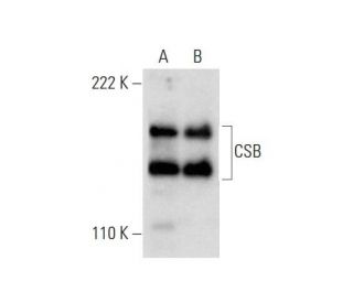 CSB Antibody (E-6) - Western Blotting - Image 300462 