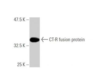 CT-R Antibody (2F7) - Western Blotting - Image 348448