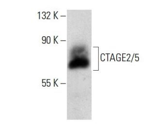 CTAGE2/5 Antibody (B-1): sc-365330