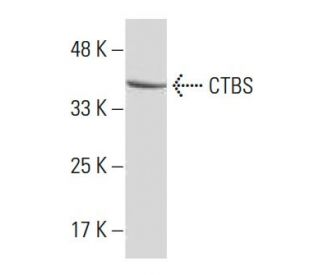 CTBS Antibody (RF-18) - Western Blotting - Image 33860