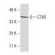 CTBS Antibody (RF-18) - Western Blotting - Image 33860