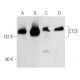 western blotting image from recommended CTCF (G-8) monoclonal antibody replacement. Image 354693