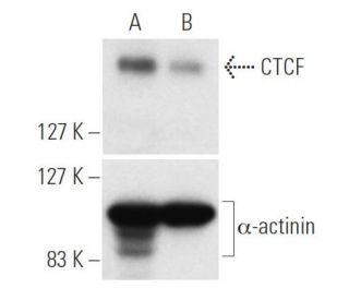 CTCF siRNA (h): sc-35124. Western blot analysis of CTCF expression in non-transfected control (A) and CTCF siRNA transfect 