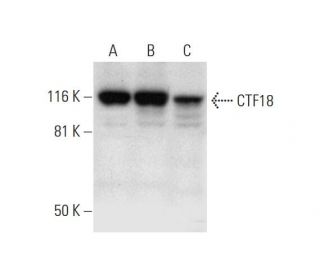 CTF18 Antibody (B-7): sc-376074