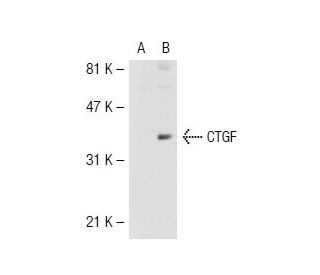 CTGF Antibody (6B13) - Western Blotting - Image 40445 