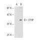 CTGF Antibody (6B13) - Western Blotting - Image 40445 