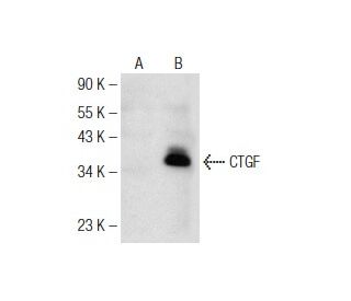 CTGF Antibody (B-6) - Western Blotting - Image 147248