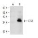 CTGF Antibody (B-6) - Western Blotting - Image 147248