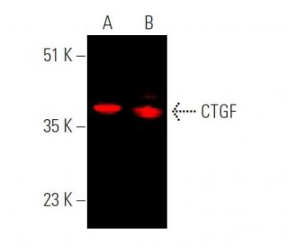 western blotting image from recommended CTGF (E-5) monoclonal antibody replacement. Image 372613