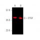 western blotting image from recommended CTGF (E-5) monoclonal antibody replacement. Image 372613