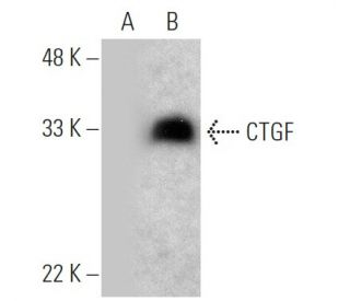 CTGF Antibody (E-5) - Western Blotting - Image 370774