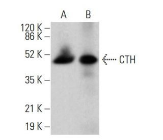 CTH Antibody (A-2) - Western Blotting - Image 380027 